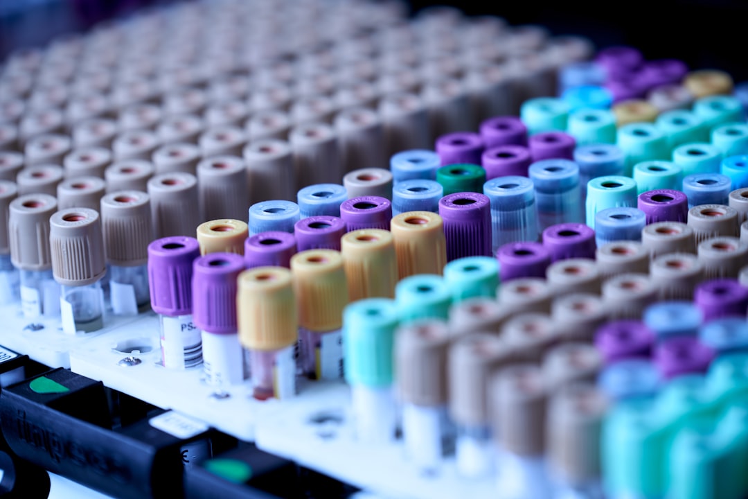 Racks of colored-capped laboratory sample tubes arranged in rows
