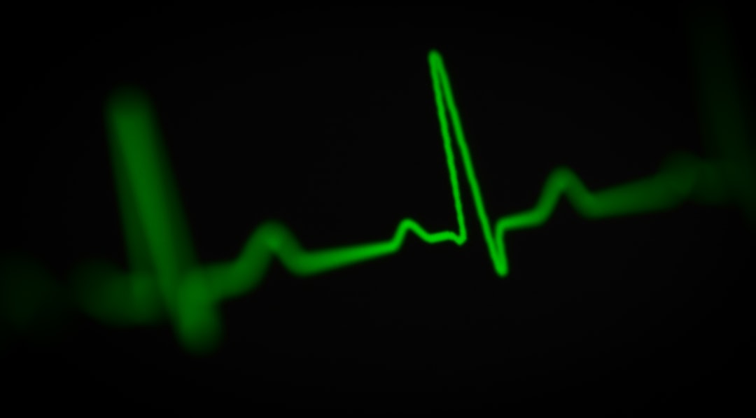 ECG waveform on a cardiac monitor showing a heart rhythm trace